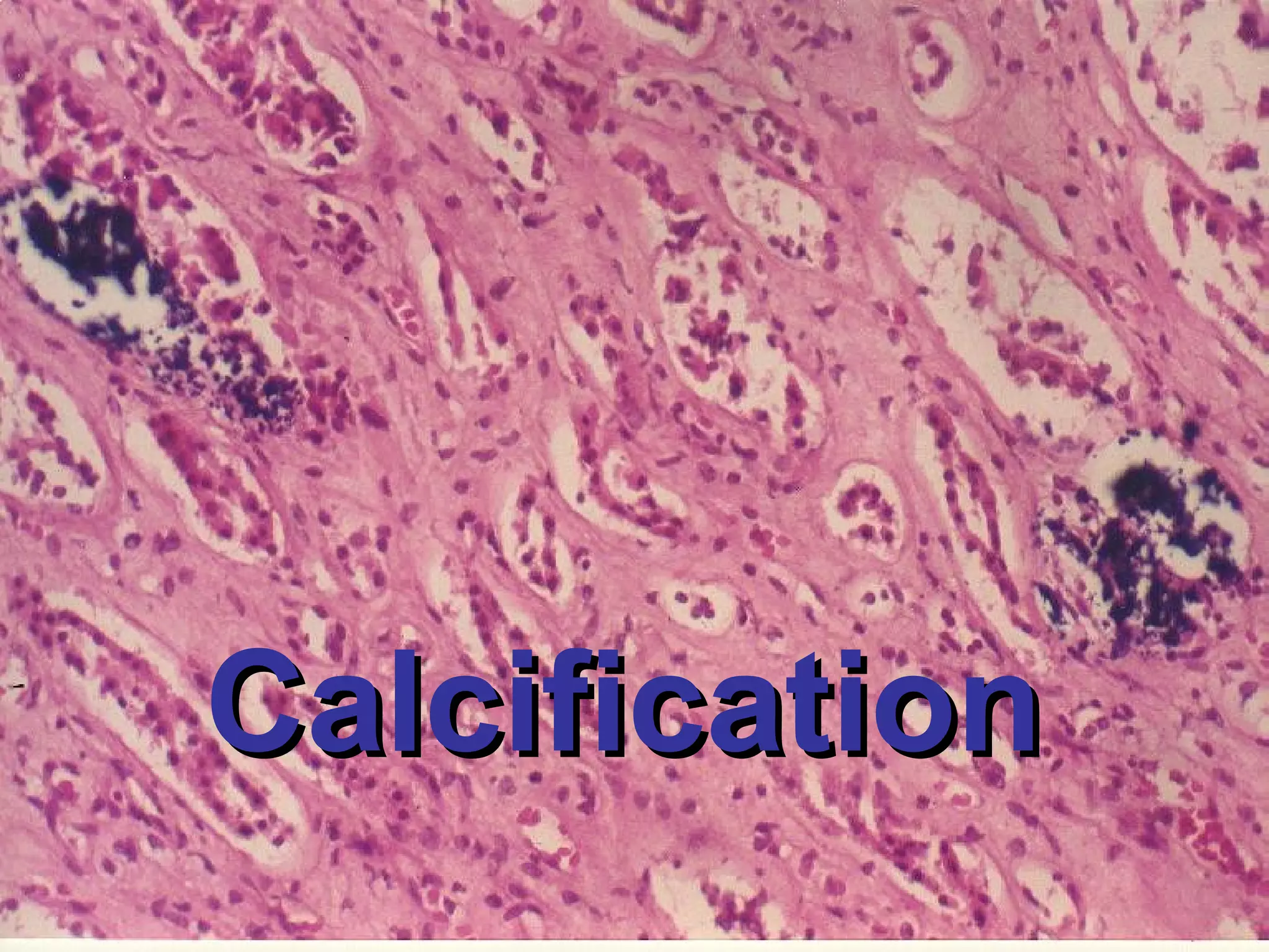 CCaallcciiffiiccaattiioonn 
 