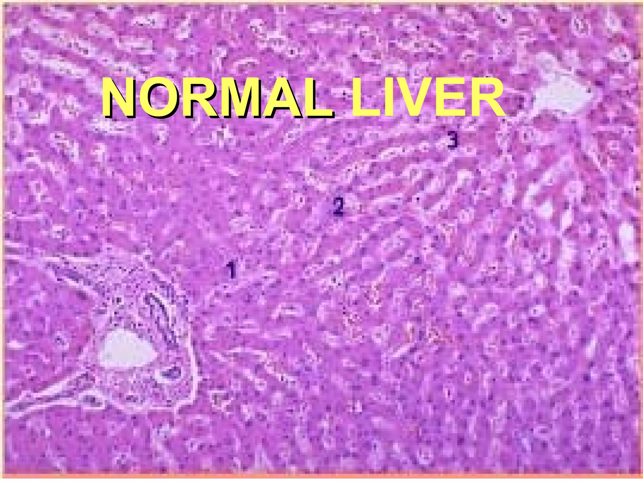 NNOORRMMAALL LIVER 
 
