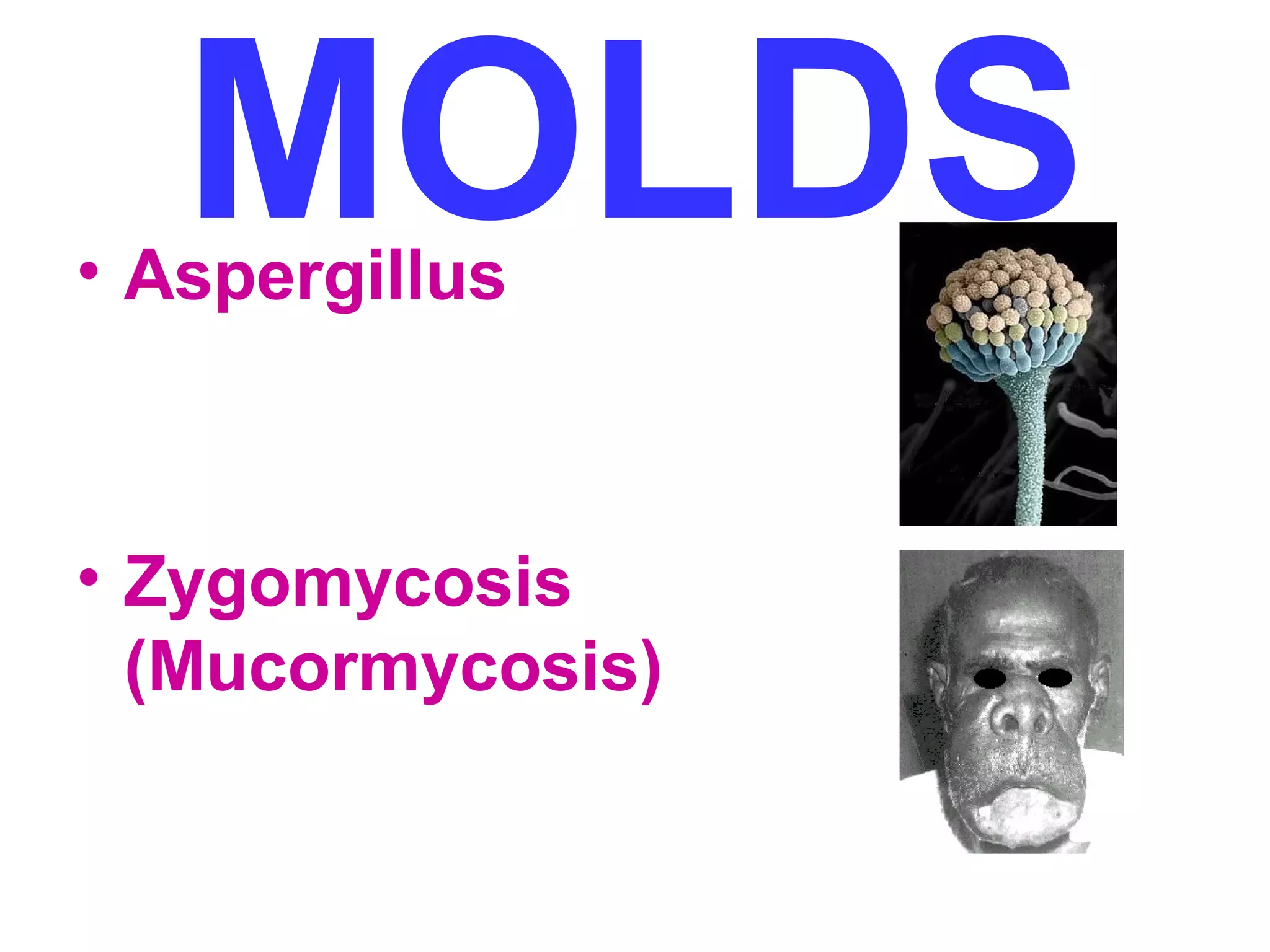MOLDS • Aspergillus 
• Zygomycosis 
(Mucormycosis) 
 