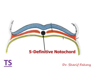 5-Definitive Notochord
TS Dr. Sherif Fahmy
 