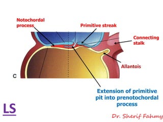 Notochordal
process
Extension of primitive
pit into prenotochordal
process
Primitive streak
Connecting
stalk
Allantois
LS Dr. Sherif Fahmy
 