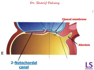 2-Notochordal
canal
Cloacal membrane
Allantois
LS
Dr. Sherif Fahmy
 