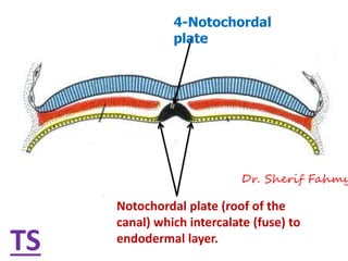 4-Notochordal
plate
Notochordal plate (roof of the
canal) which intercalate (fuse) to
endodermal layer.
TS
Dr. Sherif Fahmy
 