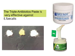 The Triple-Antibiotics Paste is
very effective against
E.faecalis
 