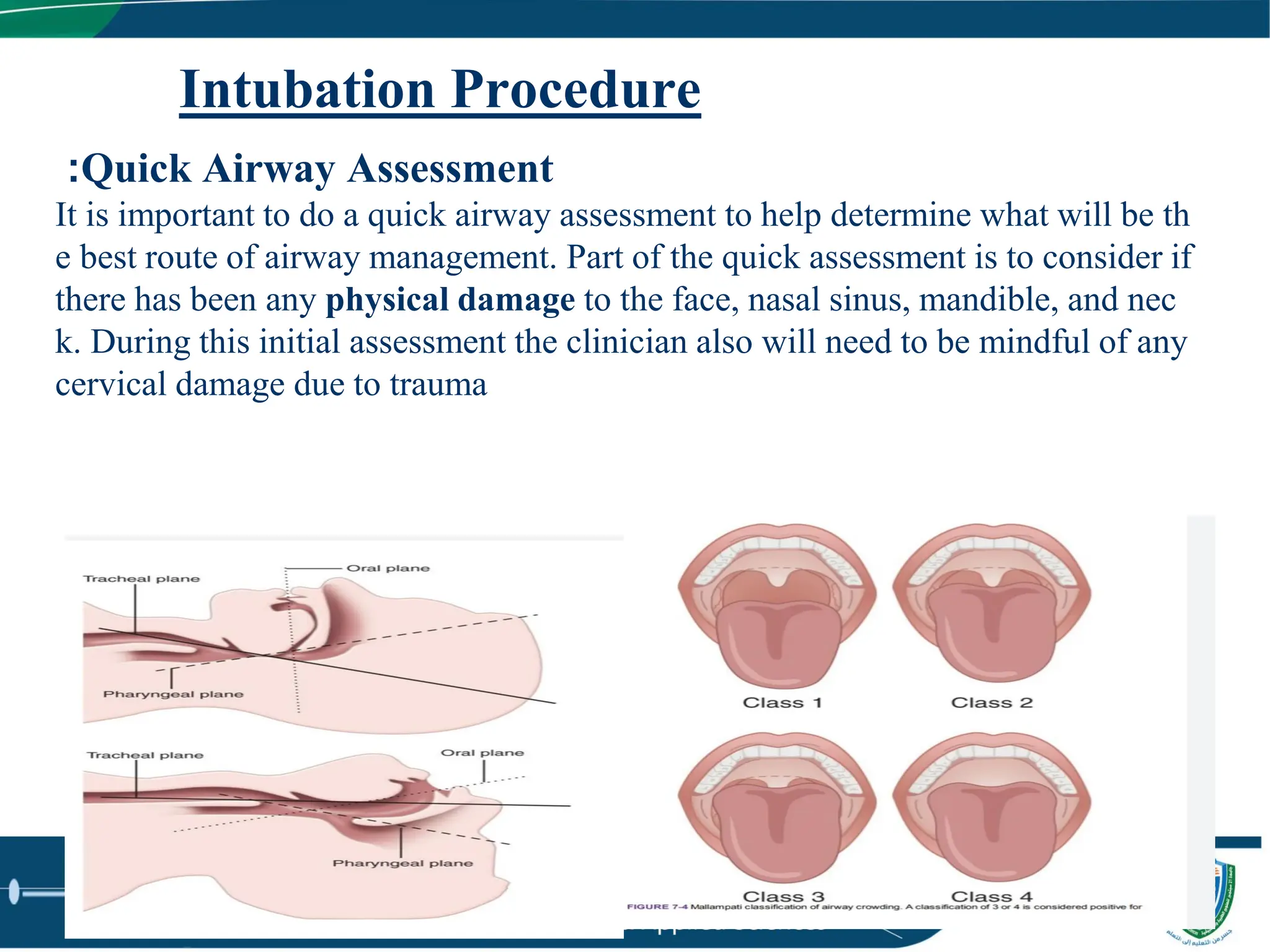 8 Intubation and tfffffffracheostomy pdf