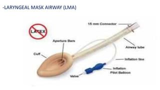 -LARYNGEAL MASK AIRWAY (LMA)
 