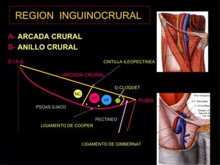 REGION  INGUINOCRURAL   A-   ARCADA CRURAL B-   ANILLO CRURAL E.I.A.S.   CINTILLA ILEOPECTINEA ARCADA CRURAL G.CLOQUET PUBIS PSOAS ILIACO PECTINEO LIGAMENTO DE COOPER LIGAMENTO DE GIMBERNAT AF VF NC 