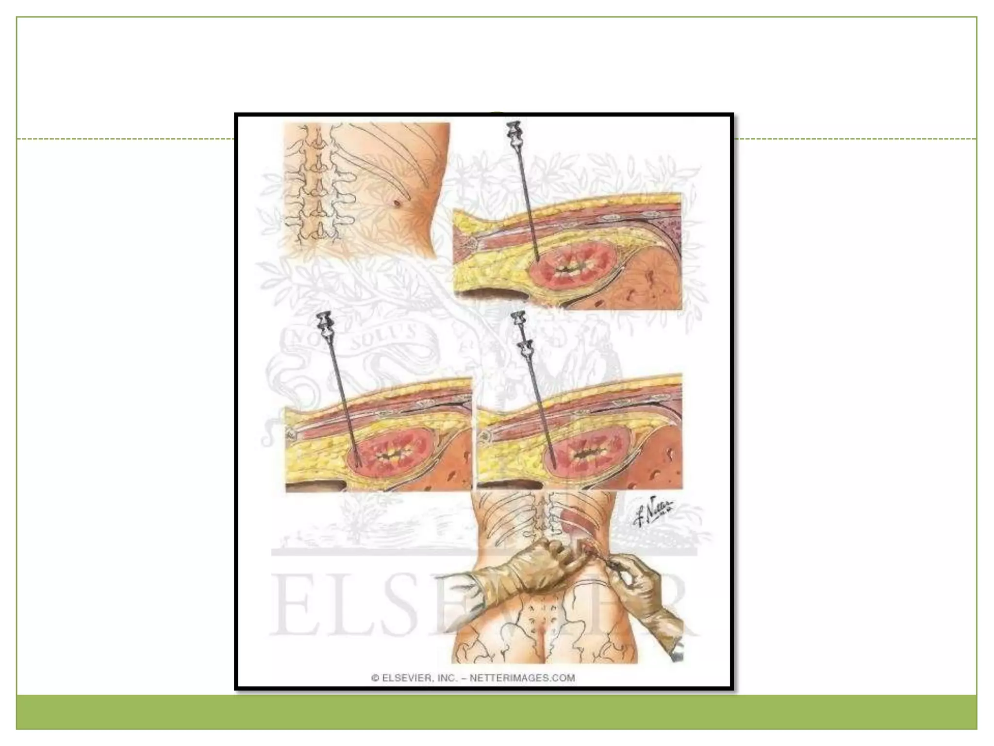 increased synthesis of clotting factors