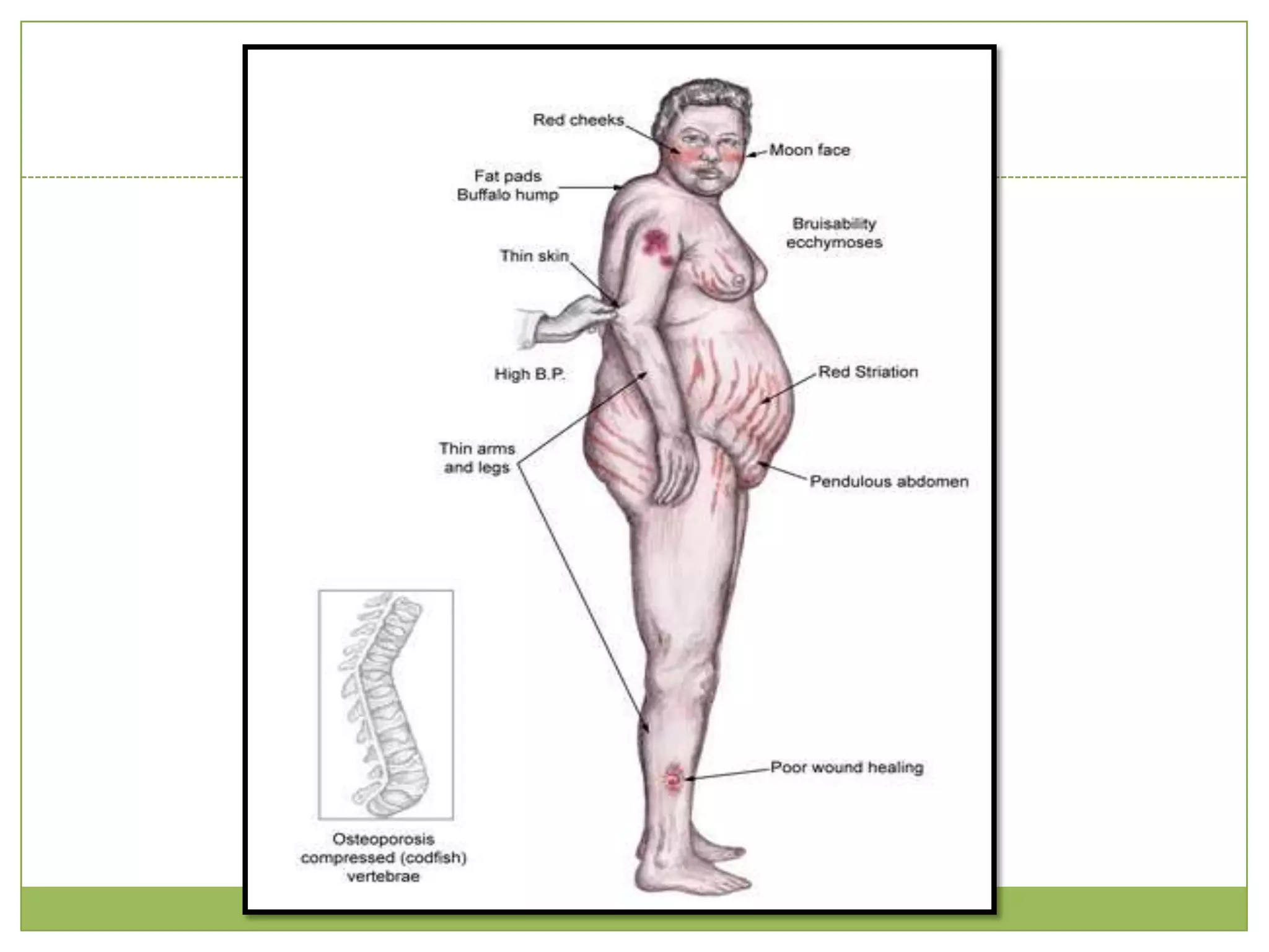 This is usually arterial and may affect the brain, limbs and splanchnic circulation
