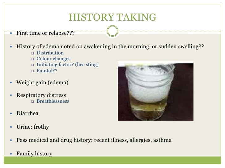 Proteinuria In Adults A Diagnostic Approach American Family Physician