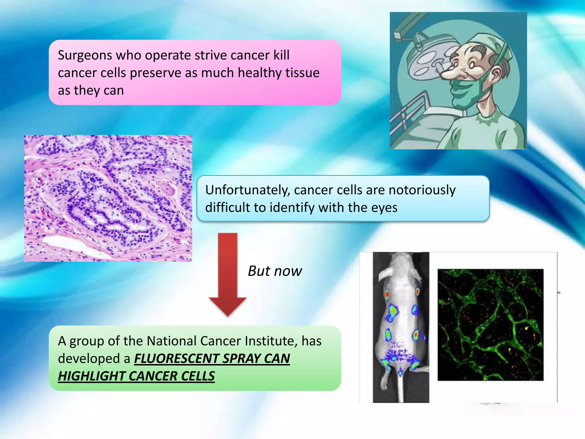 Surgeons who operate strive cancer kill
cancer cells preserve as much healthy tissue
as they can




                         Unfortunately, cancer cells are notoriously
                         difficult to identify with the eyes



                                But now



A group of the National Cancer Institute, has
developed a FLUORESCENT SPRAY CAN
HIGHLIGHT CANCER CELLS
 