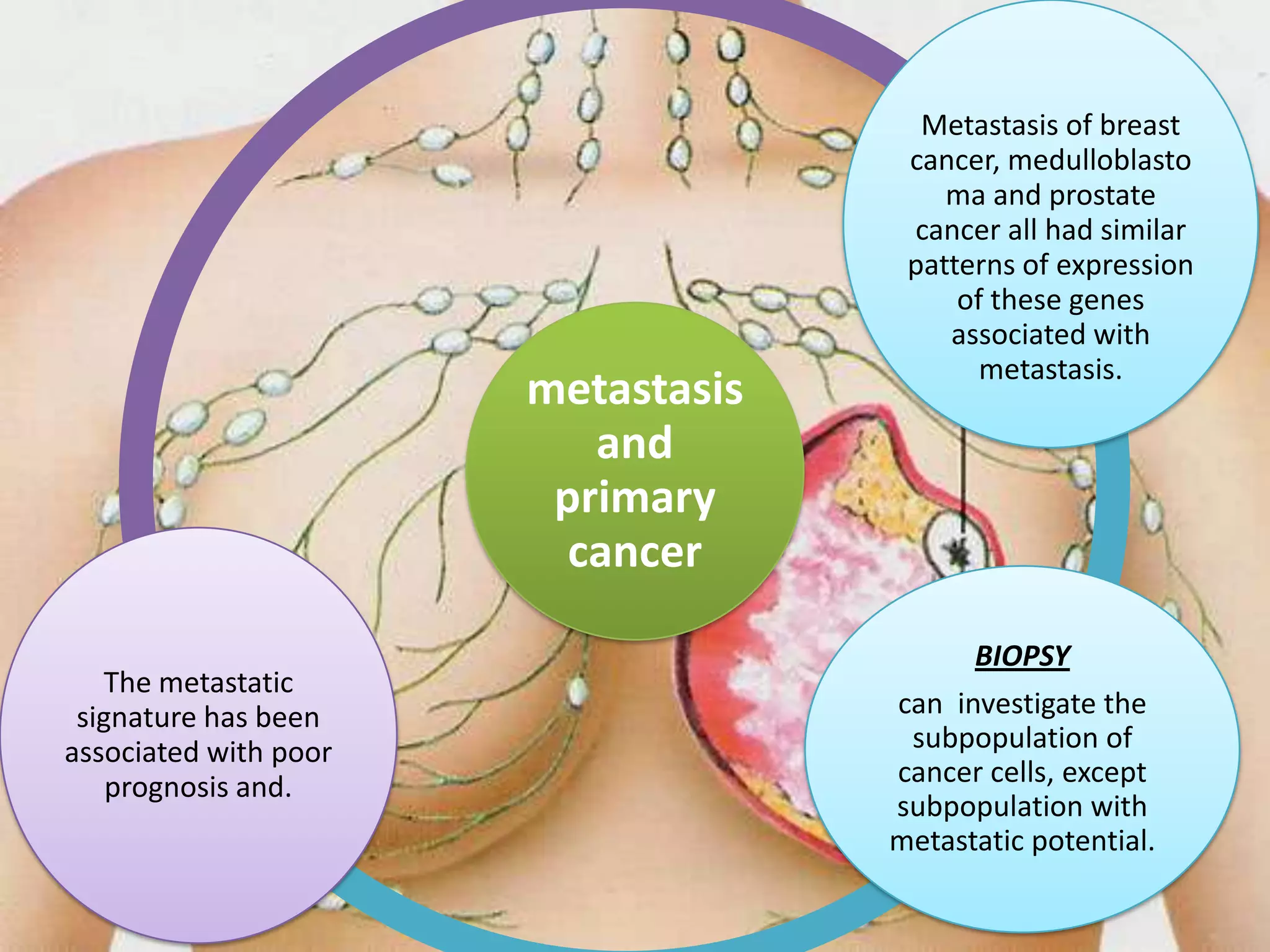 Metastasis of breast
                                     cancer, medulloblasto
                                        ma and prostate
                                     cancer all had similar
                                     patterns of expression
                                         of these genes
                                        associated with
                                           metastasis.
                       metastasis
                          and
                        primary
                         cancer

                                          BIOPSY
   The metastatic
 signature has been                 can investigate the
associated with poor                 subpopulation of
    prognosis and.                  cancer cells, except
                                    subpopulation with
                                    metastatic potential.
 