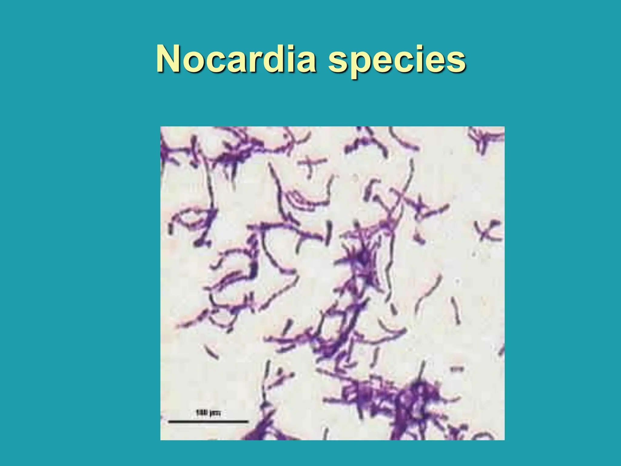 Nocardia species
 