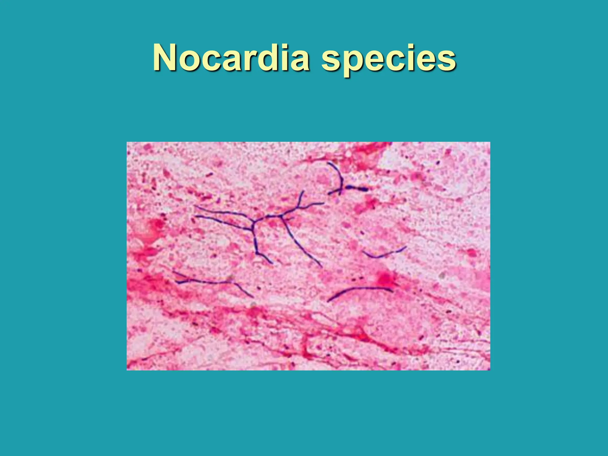 Nocardia species
 