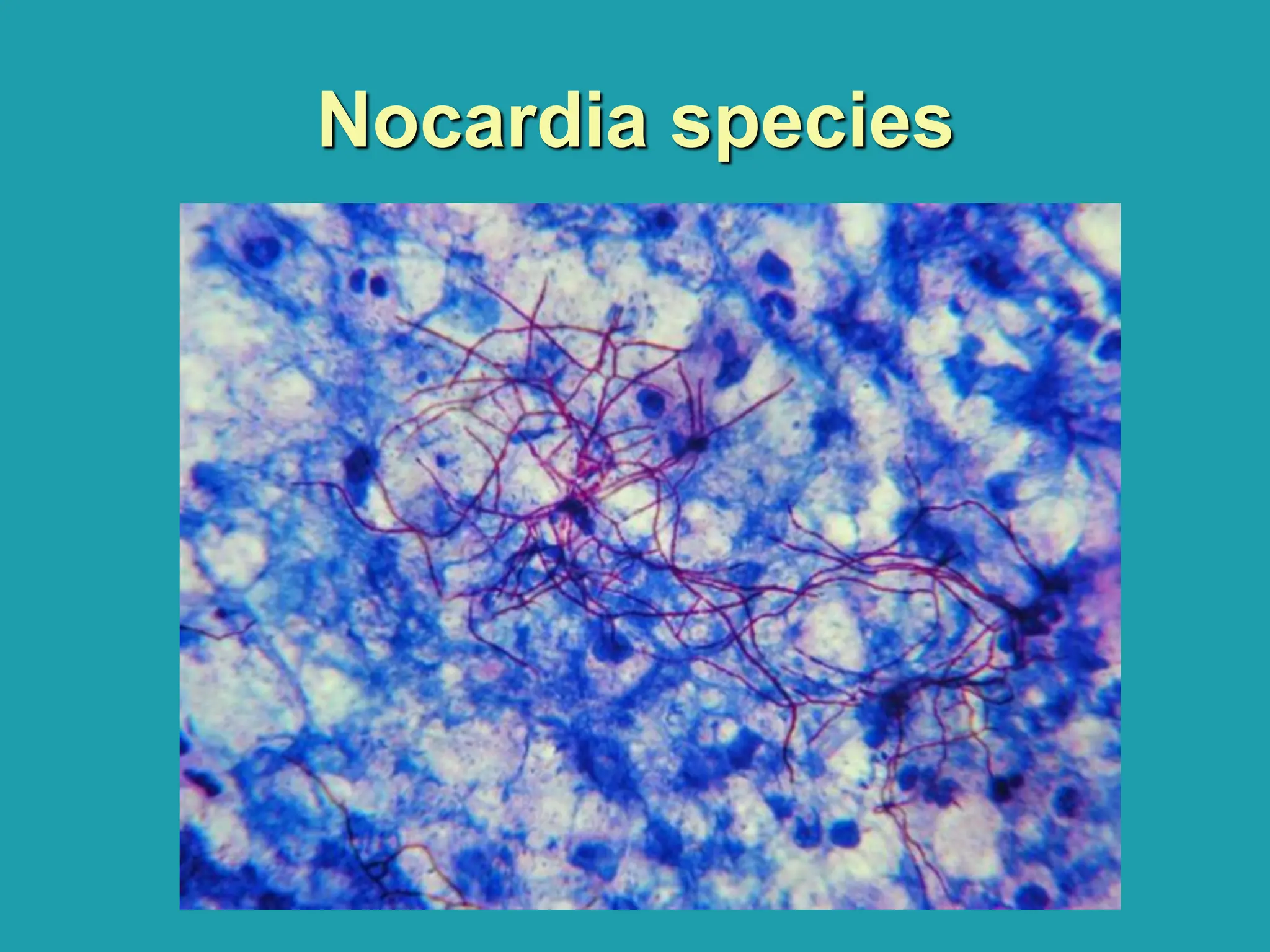 Nocardia species
 