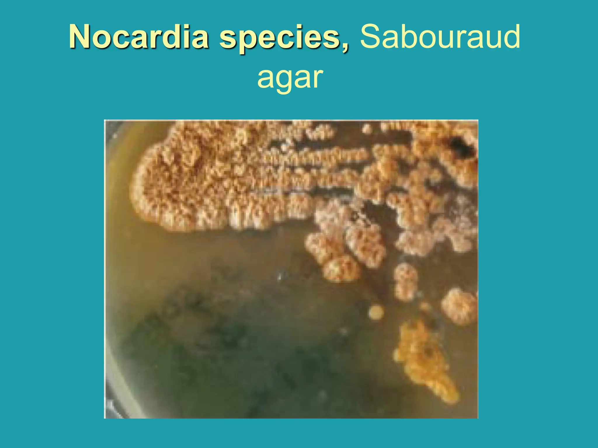 Nocardia species, Sabouraud
agar
 