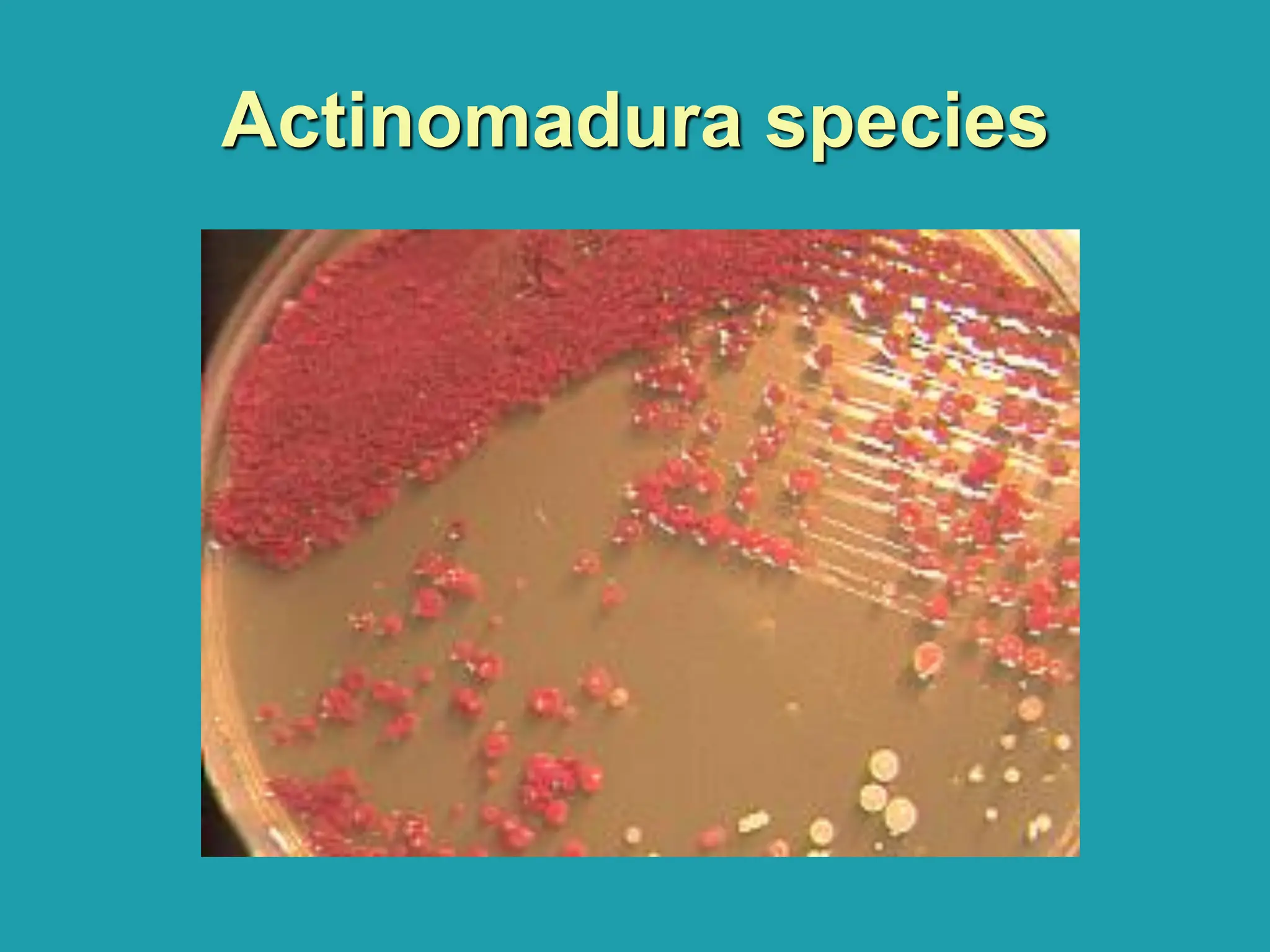 Actinomadura species
 