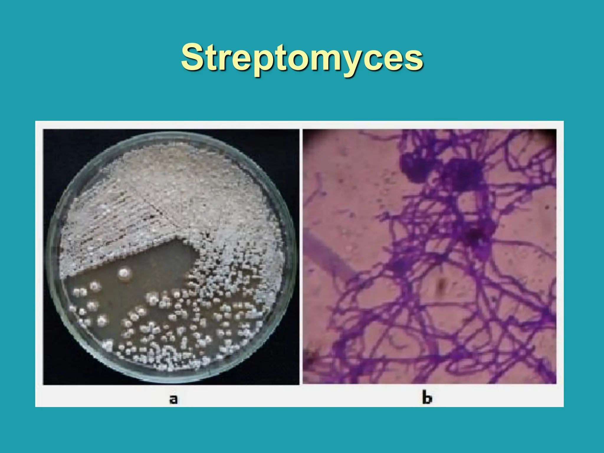 Streptomyces
 