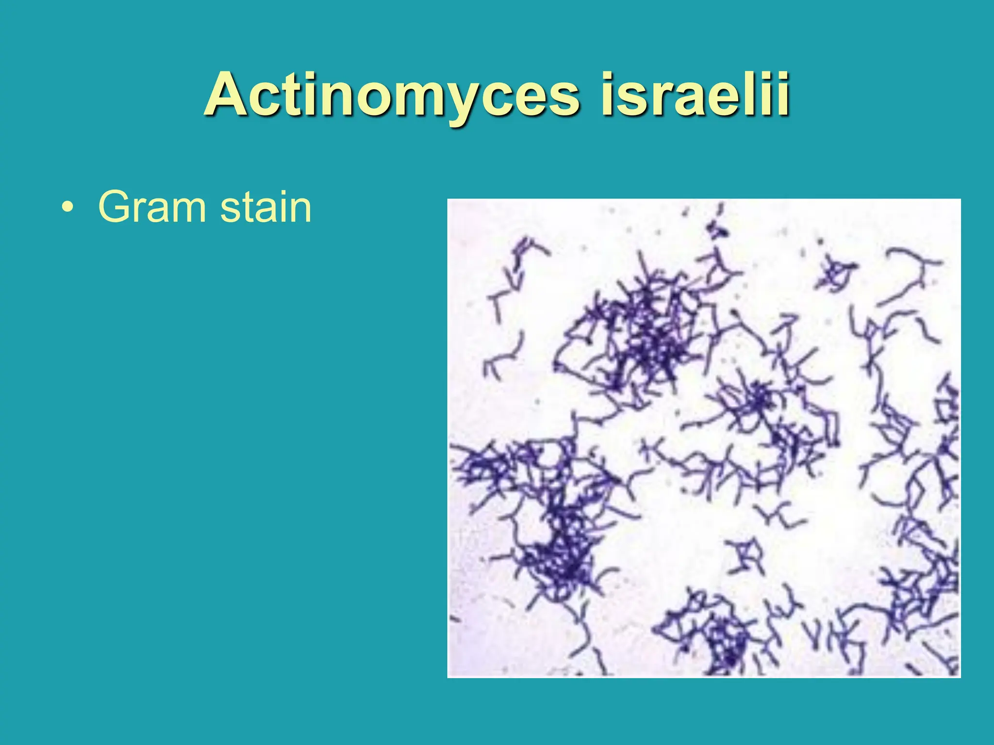 Actinomyces israelii
• Gram stain
 