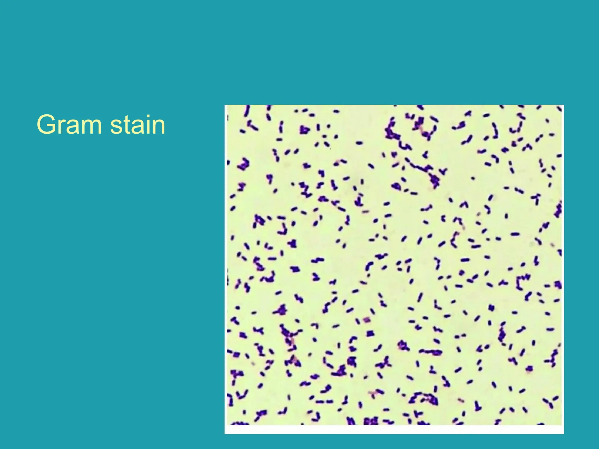 Gram stain
 