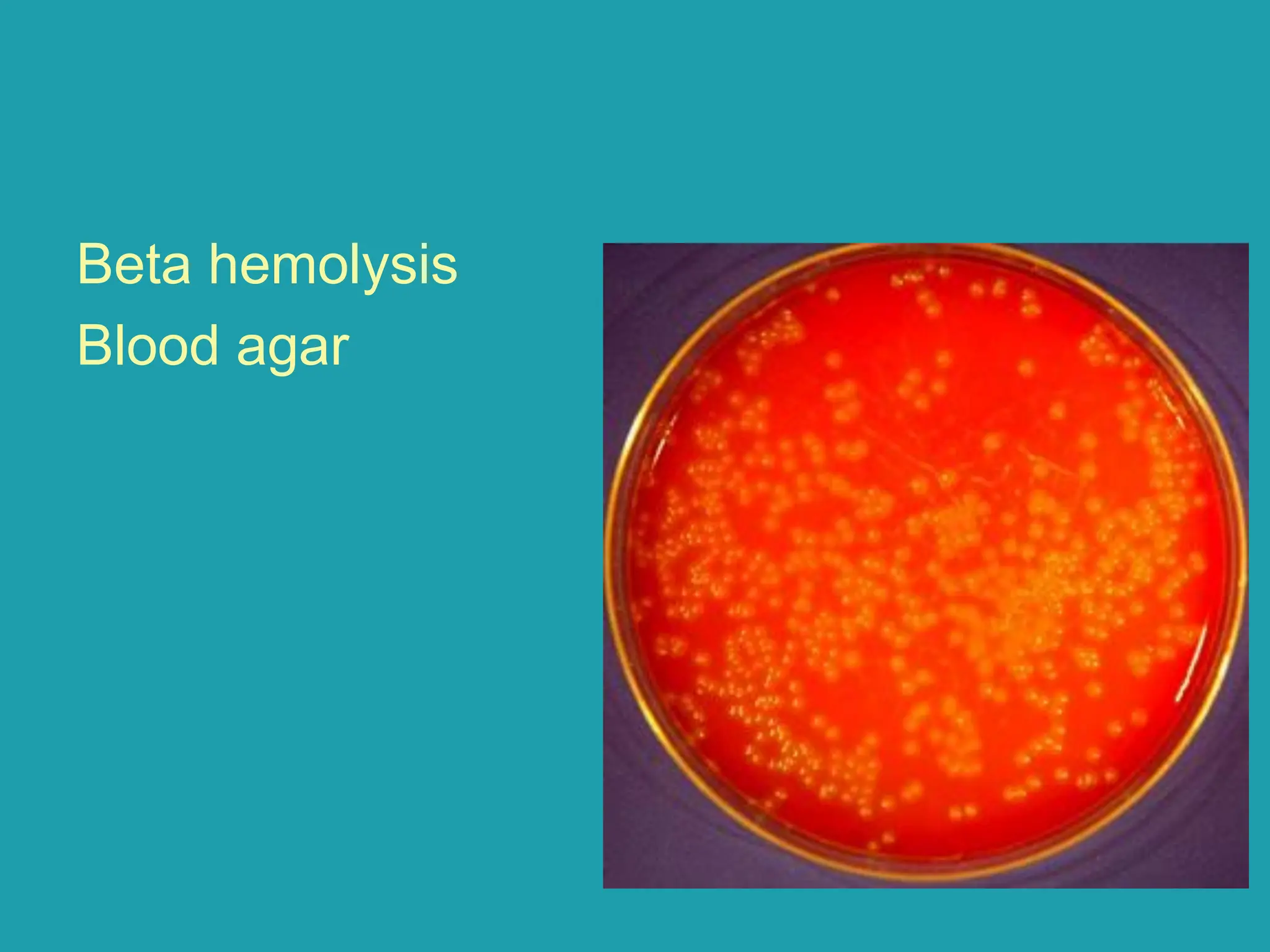 Beta hemolysis
Blood agar
 