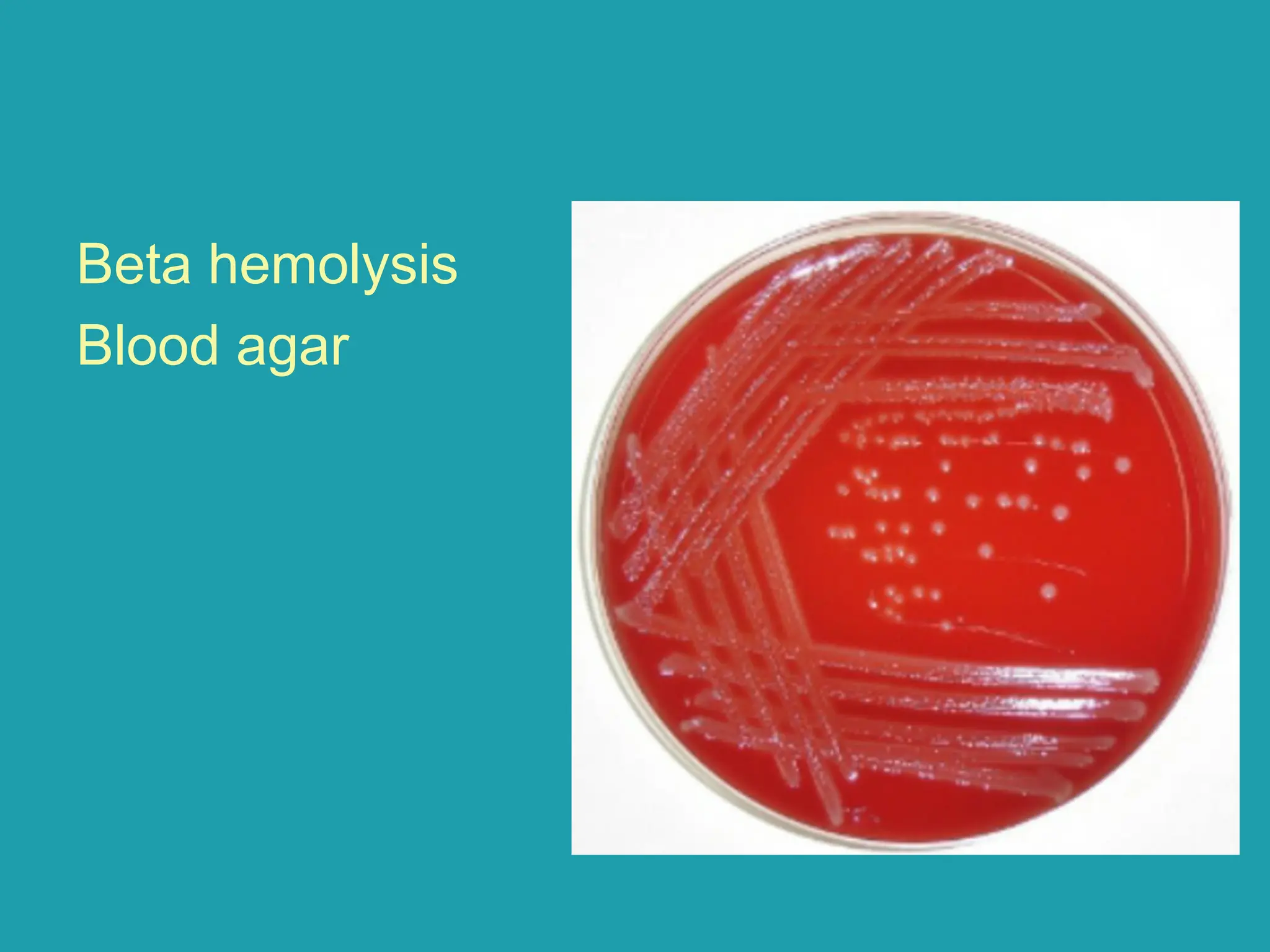 Beta hemolysis
Blood agar
 