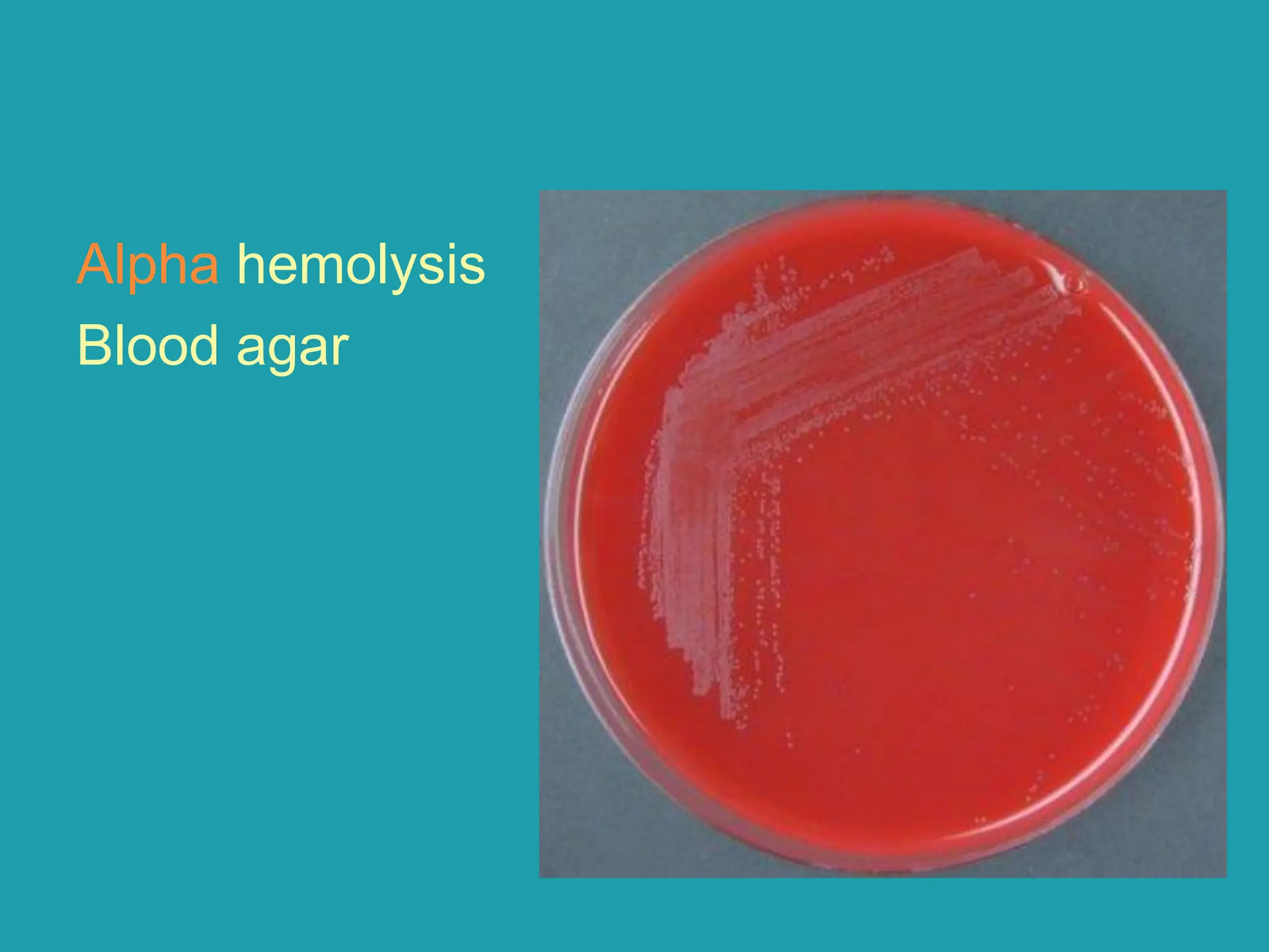 Alpha hemolysis
Blood agar
 