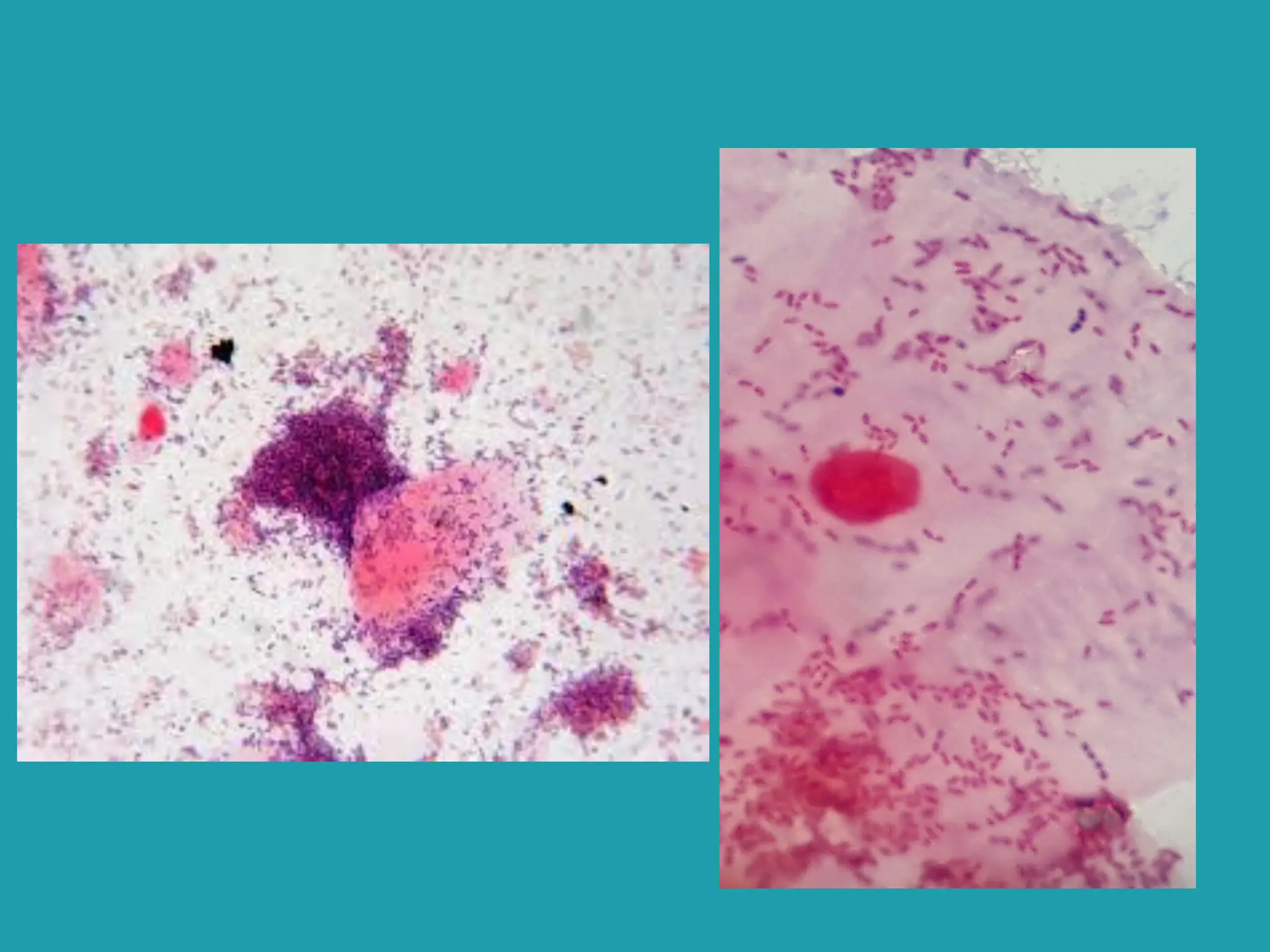 Gram positive bacilli morphology and classification