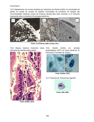 Parasitologia II
444
10.4) Atapetamento da mucosa duodenal por trofozoítos de Giardia lamblia: A) amontoados de
giárdia em porção da mucosa do duodeno (microscopia de varredura); B) redução das
microvilosidades intestinais (marca de ferradura deixada pelo disco suctorial); e C) trofozoíto
repousando sobre o enterócito (microscopia eletrônica).
Fonte: A e B) Neves, 2005; C) Dias, 2012.
10.5) Biopsia intestinal mostrando vários
trofozoítos de Giardia lamblia (setas).
Fonte: Ghaffar, 2010.
10.6) Giardia lamblia em achados
parasitológicos (EPF) em fezes diarreicas (A.
trofozoítos) e formadas (B. Cistos):
Fonte: Ghaffar, 2010.
10.7) Trofozoíto de Trichomonas vaginalis:
Fonte: USA, 2009.
 
