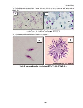 Parasitologia II
447
10.13) Amastígotas de Leishmania (setas) em histopatológicos em biópsias de pele (A) e medula
óssea (B):
Fonte: Acervo da Disciplina Parasitologia – DFP/UFPB
10.14) Promastígotas de Leishmania em cultura axênica:
Fonte: A) Acervo da Disciplina Parasitologia – DFP/UFPB; B) HOPKINS, 2011.
 