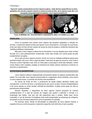 Parasitologia II
476
Figura 25: Lesões características de larva migrans cutânea – lesão dérmica serpentiforme ou bicho
geográfico (A) e de larva migrans visceral no exame de fundo de olho, larva migrans ocular (B), e em
tomografia computadorizada de abdômen, larva migrans hepática (C):
Fonte: A) MORAIS, 2011; B) KLINTWORTH; WADSWORTH, 2003; e C) CHANG et al., 2006
PROFILAXIA
Como os parasitos que causam larva migrans são parasitos adaptados a infecção em
animais, o tratamento destes animais que figuram como reservatórios, incineração de suas fezes,
evitar que estes animais tenham acesso às caixas de areia de praças e ambientes escolares são
medidas profiláticas interessantes.
Mas para a larva migrans cutânea faz-se necessário o uso de calçados para evitar contato
da pele com o solo potencialmente contaminado, evitar este contato com outras partes da pele
complementam as ações.
Já no caso da larva migrans visceral, entram em cena as medidas profiláticas gerais para
geohelmintíases, tais como: filtrar a água de beber, tratamento da água de consumo, lavar frutas e
verduras a serem ingeridas cruas, lavar as mãos após a evacuação e antes das refeições, manter
unhas limpas e bem cortadas, proteger os alimentos de insetos vetores mecânicos e evita-los no
domicílio ou peridomicílio.
ESTRATÉGIAS DIAGNÓSTICAS
Larva migrans cutânea é diagnosticada clinicamente devido ao aspecto característico das
lesões. Por outro lado, larva migrans visceral pode ter o diagnóstico clínico facilitado, como ocorre
na larva migrans ocular, ou precisar de exames mais elucidativos.
Ao exame de fundo de olho, o profissional de saúde poderá identificar lesões que
acompanham o caminho da larva, a semelhança do que ocorre na pele. Exames histopatológicos
e do humor aquoso ou vítreo revelam infiltrado de eosinófilos. O globo ocular pode ser total ou
parcialmente comprometido.
Noutras situações, o diagnóstico de larva migrans visceral precisará de exames
complementares. É o caso de exames de imagem que ajudam a delimitar o formato e a
localização das lesões, mas que não são específicos para o quadro. Neste caso, faz-se
necessário o uso de técnicas imunológicas onde serão pesquisadas as presenças de antígenos
do parasito ou de anticorpos específicos contra os parasitos em questão.
Por diversas vezes, devido às dificuldades no diagnóstico de larva migrans visceral, a
suspeita clínica se confirma quando o tratamento específico anti-helmíntico é bem sucedido.
 