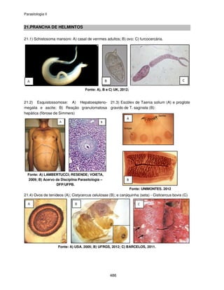 Parasitologia II
486
21.PRANCHA DE HELMINTOS
21.1) Schistosoma mansoni: A) casal de verrmes adultos; B) ovo; C) furcocercária.
Fonte: A), B e C) UK, 2012;
21.2) Esquistossomose: A) Hepatoespleno-
megalia e ascite; B) Reação granulomatosa
hepática (fibrose de Simmers)
Fonte: A) LAMBERTUCCI; RESENDE; VOIETA,
2009; B) Acervo da Disciplina Parasitologia –
DFP/UFPB.
21.3) Escólex de Taenia solium (A) e proglote
gravido de T. saginata (B):
Fonte: UNIMONTES. 2012
21.4) Ovos de tenídeos (A); Cistycercus celulosae (B); e canjiquinha (seta) - Cisticercus bovis (C)
Fonte: A) USA. 2005; B) UFRGS, 2012; C) BARCELOS, 2011.
 