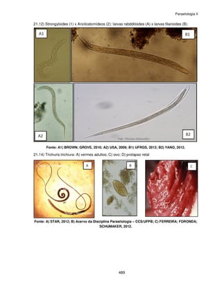 Parasitologia II
489
21.12) Strongyloides (1) x Ancilostomídeos (2): larvas rabdditoides (A) x larvas filarioides (B)
Fonte: A1) BROWN; GROVE, 2010; A2) USA, 2009; B1) UFRGS, 2012; B2) YANO, 2012.
21.14) Trichuris trichiura: A) vermes adultos; C) ovo; D) prolapso retal
Fonte: A) STAR, 2012; B) Acervo da Disciplina Parasitologia – CCS/UFPB; C) FERREIRA; FORONDA;
SCHUMAKER, 2012.
 