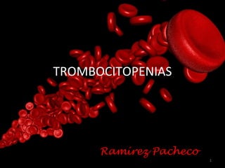 TROMBOCITOPENIAS Ramírez Pacheco 
