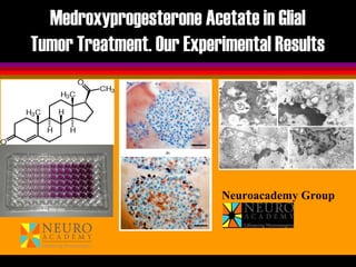 Medroxyprogesterone Acetate in Glial
Tumor Treatment. Our Experimental Results
Neuroacademy Group
 