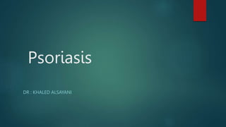 Psoriasis
DR : KHALED ALSAYANI
 