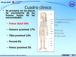 Cuadro clínico
• Se presenta en las placas
  de crecimiento de los
  huesos largos de las
  extremidades:

   – Fémur distal 58%

   – Húmero proximal 17%

   – Tibia proximal 13%

   – Peroné 6%

   – Fémur proximal 3%
 
