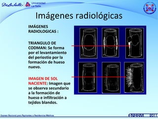 Imágenes radiológicas
IMÁGENES
RADIOLOGICAS :

TRIANGULO DE
CODMAN: Se forma
por el levantamiento
del periostio por la
formación de hueso
nuevo.

IMAGEN DE SOL
NACIENTE: Imagen que
se observa secundario
a la formación de
hueso e infiltración a
tejidos blandos.
 