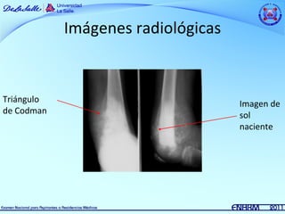 Imágenes radiológicas


Triángulo                           Imagen de
de Codman                           sol
                                    naciente
 