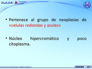 • Pertenece al grupo de neoplasias de
  «celulas redondas y azules»

• Núcleo     hipercromático   y   poco
  citoplasma.
 