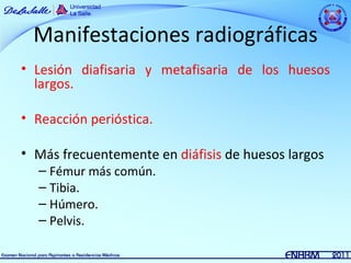 Manifestaciones radiográficas
• Lesión diafisaria y metafisaria de los huesos
  largos.

• Reacción perióstica.

• Más frecuentemente en diáfisis de huesos largos
  – Fémur más común.
  – Tibia.
  – Húmero.
  – Pelvis.
 