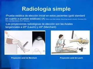 -Prueba estática de elección inicial en estos pacientes (gold standard
en cuanto a pruebas estáticas) (A) (Work Loss Data Institute. Knee & leg (acute & chronic). Encinitas (CA):
Work Loss Data Institute; 2011. Various p.)

-Las proyecciones radiológicas de elección son las Axiales
tangenciales a 20º (Laurin) y 45º (Merchant)




          Proyección axial de Merchant.                                Proyección axial de Laurin
 