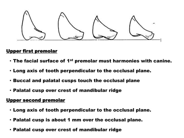 8 - setting of teeth for class I, II and II arch relation ship (Edited)