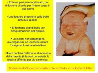 • Eritema periorale localizzato, poi
diffusione di bolle per l’intero corpo in
               due giorni

 • Una leggera pressione sulle bolle
          rimuove la pelle

    • Si formano grandi bolle con
     desquamazione dell’epitelio

     • Le lesioni non contengono
  microrganismi nè leucociti (natura
    tossigena, tossina esfoliativa)

• Il feto contrae l’infezione al momento
  della nascita (infezioni connatali), la
   tossina diffonde per via sistemica


   Sindrome stafilococcica della cute scottata o malattia di Ritter
 