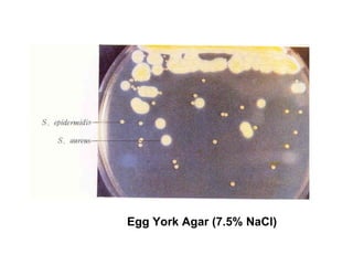 Egg York Agar (7.5% NaCl)
 