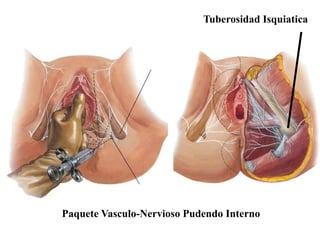 Tuberosidad Isquiatica

Paquete Vasculo-Nervioso Pudendo Interno

 