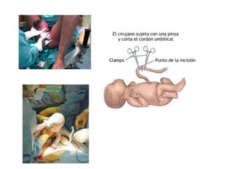 8  suelo pelvico o perine