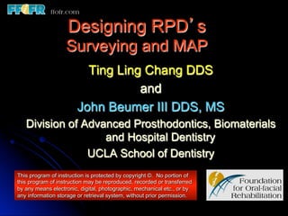 Designing RPD’s
                   Surveying and MAP
                         Ting Ling Chang DDS
                                  and
                       John Beumer III DDS, MS
   Division of Advanced Prosthodontics, Biomaterials
                   and Hospital Dentistry
                UCLA School of Dentistry
This program of instruction is protected by copyright ©. No portion of
this program of instruction may be reproduced, recorded or transferred
by any means electronic, digital, photographic, mechanical etc., or by
any information storage or retrieval system, without prior permission.
 