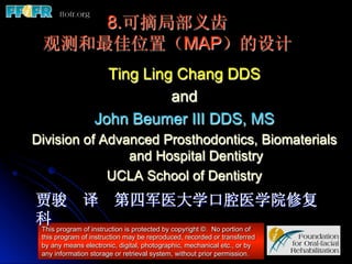 8.可摘局部义齿
 观测和最佳位置（MAP）的设计
                    Ting Ling Chang DDS
                             and
                  John ...