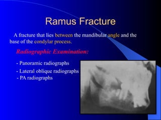 -Trauma to Teeth and Facial Structures.pptx